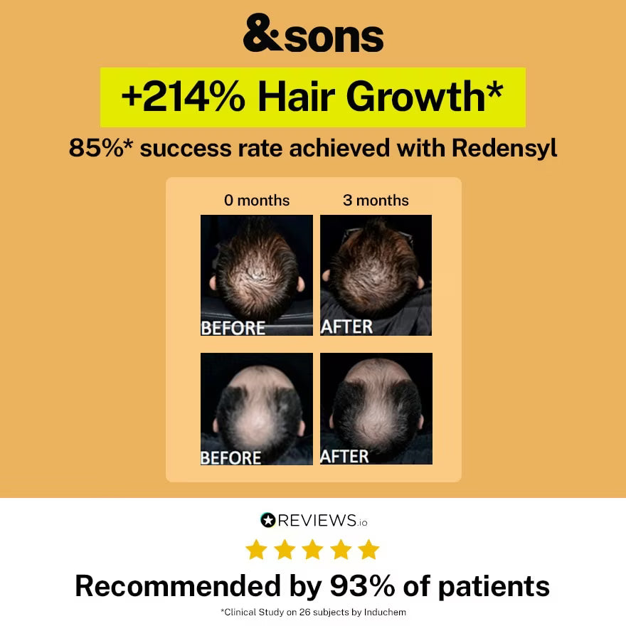 Advertisement for &sons hair growth product with before and after images and success rate information.