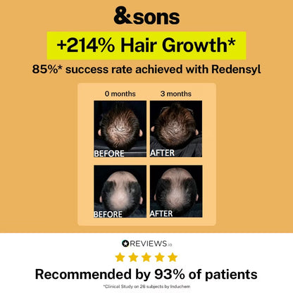 Advertisement for &sons hair growth product with before and after images and success rate information.